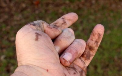 Ciemne plamy na kolanach – co mogą sygnalizować?