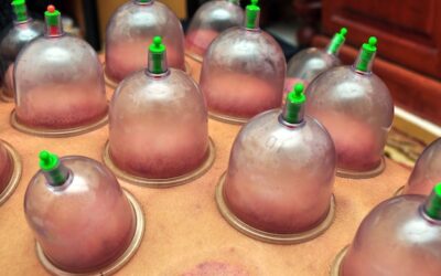 Jak długo powinno trwać stawianie baniek chińskich?