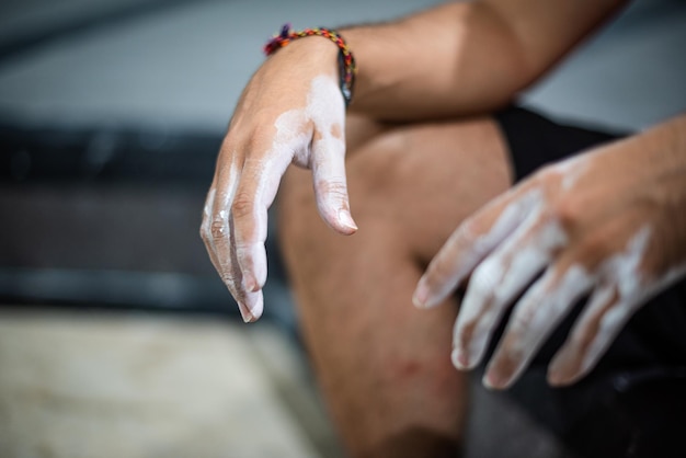 Jak skutecznie zlikwidować ciemne plamy na kolanach?