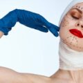 Bioplastia czy nanoplastia co wybrać dla swoich włosów?
